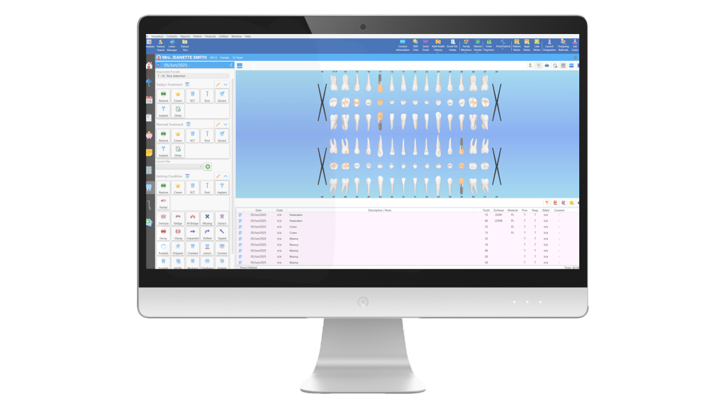 ABELDent Software odontogram open on a computer monitor.
